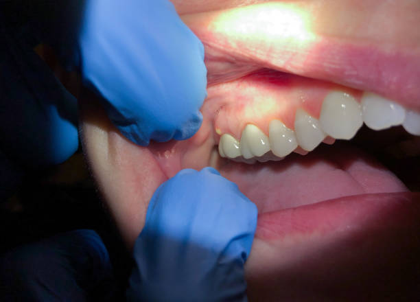 Best Urgent Dental Care for Toothache in Ho Ho Kus, NJ