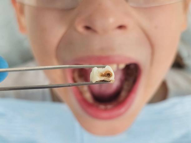 Best Pediatric Emergency Dentist in Ho Ho Kus, NJ